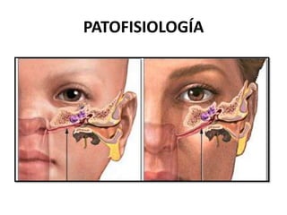 PATOFISIOLOGÍA
 