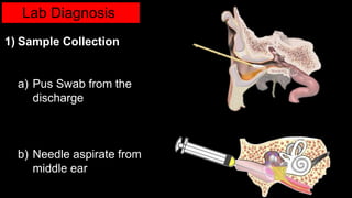 Lab Diagnosis
1) Sample Collection
a) Pus Swab from the
discharge
b) Needle aspirate from
middle ear
 