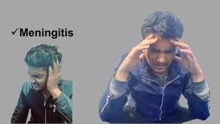 Meningitis
 