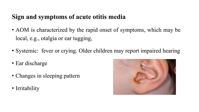 Otitis media in children | PPTX | Ear, Nose and Throat Conditions ...