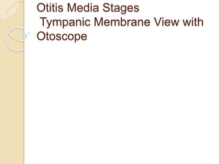 Otitis Media Stages
Tympanic Membrane View with
Otoscope
 