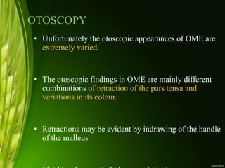 OTOSCOPY
• Unfortunately the otoscopic appearances of OME are
extremely varied.
• The otoscopic findings in OME are mainly different
combinations of retraction of the pars tensa and
variations in its colour.
• Retractions may be evident by indrawing of the handle
of the malleus
 
