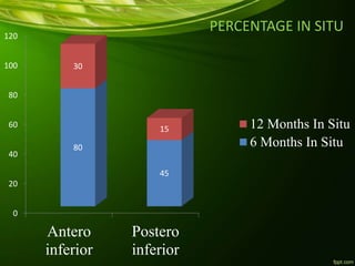 PERCENTAGE IN SITU
0
20
40
60
80
100
120
Antero
inferior
Postero
inferior
80
45
30
15 12 Months In Situ
6 Months In Situ
 