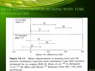 MEAN IMPROVEMENT IN HEARING WITH TUBE
METAANALYSIS
 