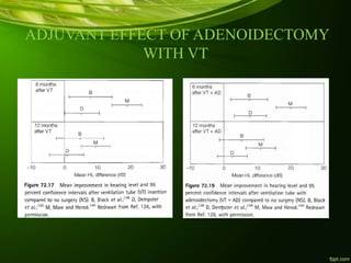 ADJUVANT EFFECT OF ADENOIDECTOMY
WITH VT
 