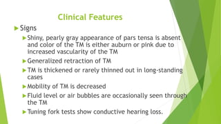 Otitis Media With Effusion.pptx