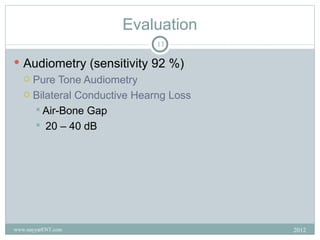 Evaluation
                             13

 Audiometry (sensitivity 92 %)
   Pure Tone Audiometry

   Bilateral Conductive Hearng Loss

     Air-Bone Gap
     20 – 40 dB




www.nayyarENT.com                      2012
 