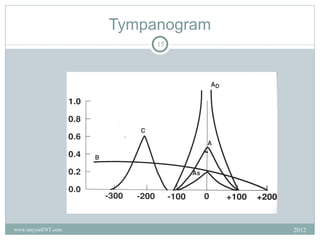 Tympanogram
                         15




www.nayyarENT.com                 2012
 