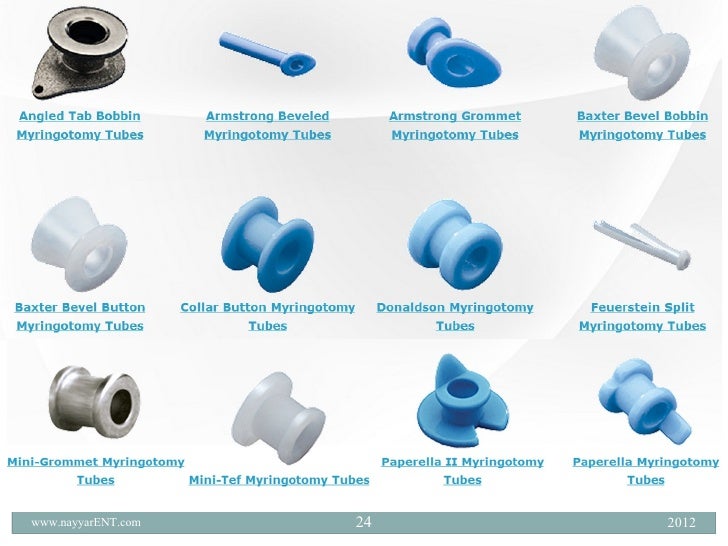 Otitis media with effusion ome