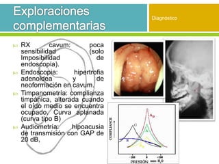 RX cavum: poca
sensibilidad (solo
Imposibilidad de
endoscopia).
 Endoscopia: hipertrofia
adenoidea y de
neoformación en cavum.
 Timpanometría: complianza
timpánica, alterada cuando
el oído medio se encuentra
ocupado. Curva aplanada
(curva tipo B)
 Audiometría: hipoacusia
de transmisión con GAP de
20 dB,
Diagnóstico
 