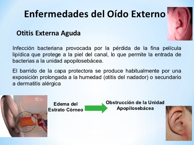 Duele los músculos del cuello que hacer