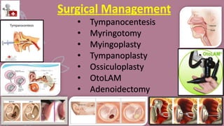 Surgical Management
• Tympanocentesis
• Myringotomy
• Myingoplasty
• Tympanoplasty
• Ossiculoplasty
• OtoLAM
• Adenoidectomy
 