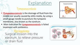  Tympanocentesis is the drainage of fluid from the
middle ear usually caused by otitis media, by using a
small-gauge needle to puncture the tympanic
membrane, also known as the eardrum.
 Main indication for tympanocentesis is failed
treatment with antibiotics.
Tympanocentesis
Myringotomy
Surgical incision into the
eardrum, to relieve pressure
or drain fluid
 
