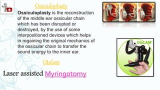 Ossiculoplasty
Ossiculoplasty is the reconstruction
of the middle ear ossicular chain
which has been disrupted or
destroyed, by the use of some
interpositioned devices which helps
in regaining the original mechanics of
the ossicular chain to transfer the
sound energy to the inner ear.
Otolam
Laser assisted Myringotomy
 