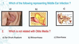 1. Which of the following representing Middle Ear Infection ?
a) b) c)
2. Which is not related with Otitis Media ?
a) Ear Drum Rupture c) Otorrhoeab) Rhinorrhoea
 