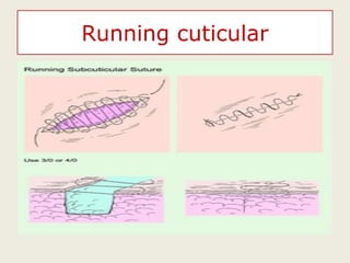 Running cuticular
 