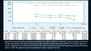 Fig. 2.14: Distortion product emissions recorded from 2000 to 6000 Hz. Note the L1 and L2 values are 65 and
55 dB, respectively. The output shown above also reports the geometric mean (GM) of F1 and F2, which is a
value in between the F1 and F2. Note the DP-NF ratio is well above 6 dB at all frequencies and the DP itself is
above –6 dB. This patient would be considered to have “passed” the test.
 