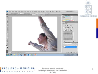 Álvaro del Valle L. Estudiante Tecnología Médica ORL III, Universidad de Chile 