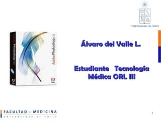 Álvaro del Valle L.  Estudiante  Tecnología Médica ORL III 