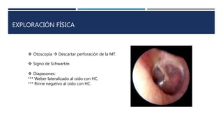 EXPLORACIÓN FÍSICA
 Otoscopía  Descartar perforación de la MT.
 Signo de Schwartze.
 Diapasones:
*** Weber lateralizado al oido con HC.
*** Rinne negativo al oido con HC.
 