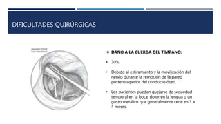 DIFICULTADES QUIRÚRGICAS
 DAÑO A LA CUERDA DEL TÍMPANO:
• 30%.
• Debido al estiramiento y la movilización del
nervio durante la remoción de la pared
posterosuperior del conducto óseo.
• Los pacientes pueden quejarse de sequedad
temporal en la boca, dolor en la lengua o un
gusto metálico que generalmente cede en 3 a
4 meses.
 