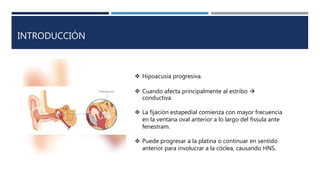 INTRODUCCIÓN
 Hipoacusia progresiva.
 Cuando afecta principalmente al estribo 
conductiva.
 La fijación estapedial comienza con mayor frecuencia
en la ventana oval anterior a lo largo del fissula ante
fenestram.
 Puede progresar a la platina o continuar en sentido
anterior para involucrar a la cóclea, causando HNS.
 