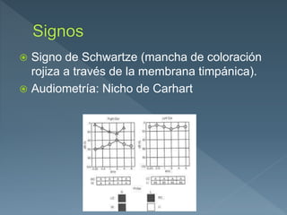  Signo de Schwartze (mancha de coloración
rojiza a través de la membrana timpánica).
 Audiometría: Nicho de Carhart
 