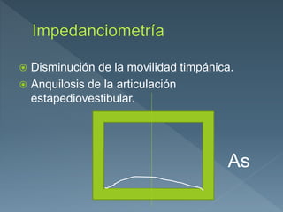  Disminución de la movilidad timpánica.
 Anquilosis de la articulación
estapediovestibular.
As
 