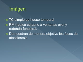  TC simple de hueso temporal
 RM (realce cercano a ventanas oval y
redonda-fenestral.
 Demuestran de manera objetiva los focos de
otosclerosis.
 