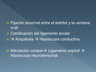  Fijación anormal entre el estribo y la ventana
oval
 Calcificación del ligamento anular
  Anquilosis  Hipoacusia conductiva
 Afectación coclear Ligamento espiral 
Hipoacusia neurosensorial
 