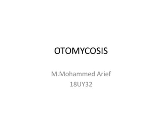 OTOMYCOSIS
M.Mohammed Arief
18UY32
 