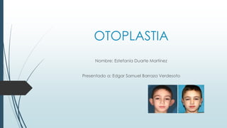 OTOPLASTIA
Nombre: Estefanía Duarte Martínez
Presentado a: Edgar Samuel Barraza Verdesoto
 
