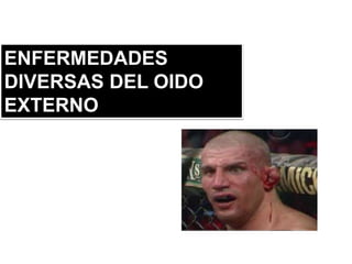 ENFERMEDADES
DIVERSAS DEL OIDO
EXTERNO
 