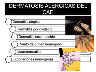 DERMATOSIS ALERGICAS DEL
CAE
Dermatitis atopica
Dermatitis por contacto
Dermatitis eccematoide
Prurito de origen neurógeno
Neurodermatitis
Excoriaciones neurógenas
 