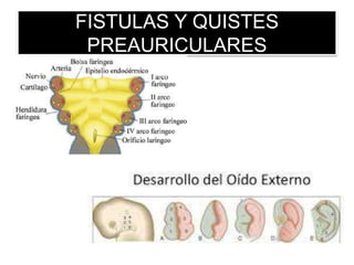 FISTULAS Y QUISTES
PREAURICULARES
 