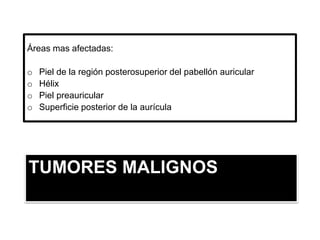TUMORES MALIGNOS
Áreas mas afectadas:
o Piel de la región posterosuperior del pabellón auricular
o Hélix
o Piel preauricular
o Superficie posterior de la aurícula
 