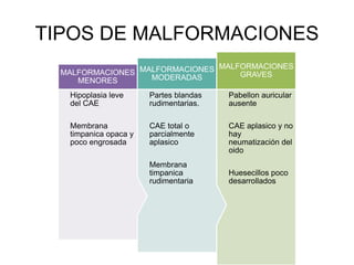 TIPOS DE MALFORMACIONES
Pabellon auricular
ausente
CAE aplasico y no
hay
neumatización del
oido
Huesecillos poco
desarrollados
MALFORMACIONES
GRAVES
Partes blandas
rudimentarias.
CAE total o
parcialmente
aplasico
Membrana
timpanica
rudimentaria
MALFORMACIONES
MODERADAS
Hipoplasia leve
del CAE
Membrana
timpanica opaca y
poco engrosada
MALFORMACIONES
MENORES
 