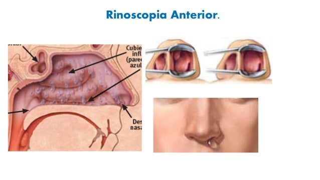 RINOSCOPIA ANTERIOR Y POSTERIOR PDF DOWNLOAD RINOSCOPIA ANTERIOR Y POSTERIOR PDF DOWNLOAD