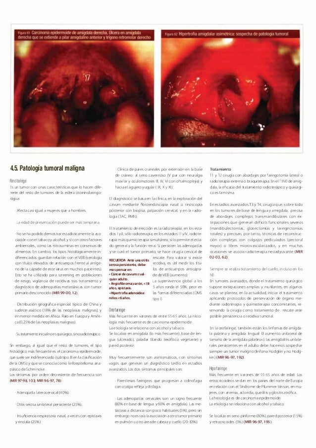 OTORRINOLARINGOLOGIA CTO 8 PDF OTORRINOLARINGOLOGIA CTO 8 PDF