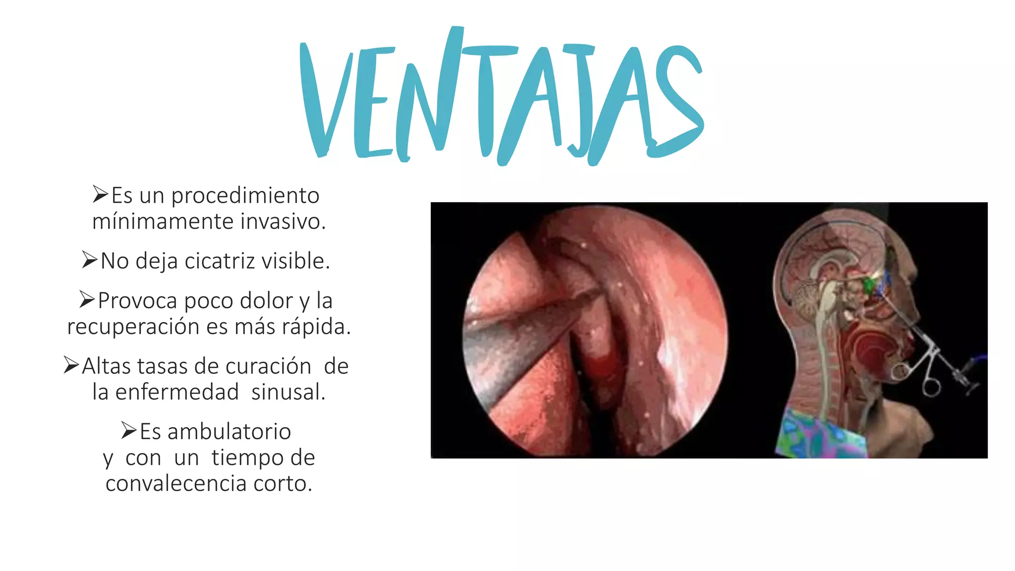 Otorrinolaringologia tecnicas quirurgicas instrumentacion quirurgica ...