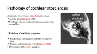 otosclerosis etiology, types and management | PPTX