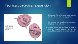 Técnica quirúrgica: exposición
• El colgajo T.M se levanta hasta que el
annulus fibroso esté bien expuesto
• Se rechaza por completo la membrana
timpánica hacia anterior
• Cuando esto no es suficiente, se debe a
que la incisión superior no se ha
extendido lo bastante en sentido anterior.
 