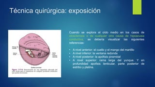 Técnica quirúrgica: exposición
Cuando se explora el oído medio en los casos de
otosclerosis o de cualquier otra causa de hipoacusia
conductiva, se debería visualizar las siguientes
referencias:
• A nivel anterior: el cuello y el mango del martillo
• A nivel inferior: la ventana redonda
• A nivel posterior: la apófisis piramidal
• A nivel superior: rama larga del yunque. Y en
profundidad apofisis lenticular, parte posterior de
estribo y platina.
 