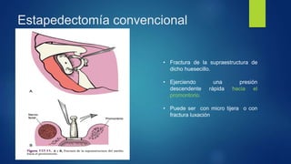 Estapedectomía convencional
• Fractura de la supraestructura de
dicho huesecillo.
• Ejerciendo una presión
descendente rápida hacia el
promontorio.
• Puede ser con micro tijera o con
fractura luxación
 
