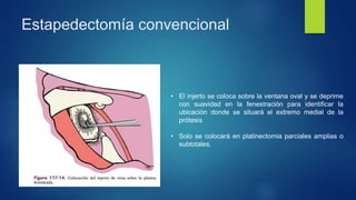 Estapedectomía convencional
• El injerto se coloca sobre la ventana oval y se deprime
con suavidad en la fenestración para identificar la
ubicación donde se situará el extremo medial de la
prótesis
• Solo se colocará en platinectomia parciales amplias o
subtotales.
 