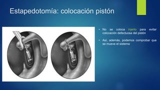 Estapedotomía: colocación pistón
• No se coloca injerto para evitar
colocación defectuosa del pistón
• Así, además, podemos comprobar que
se mueve el sistema
 