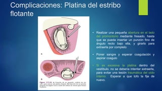 Complicaciones: Platina del estribo
flotante
• Realizar una pequeña abertura en el lado
del promontorio mediante fresado, hasta
que se pueda insertar un punzón fino de
ángulo recto bajo ella, y girarlo para
extraerla por completo
• Poner sangre y esperar coagulación y
aspirar coagulo
• Si es excesiva la platina dentro del
vestíbulo, no se debería intentar extraerla,
para evitar una lesión traumática del oído
interno. Esperar a que tofo la fije de
nuevo.
 