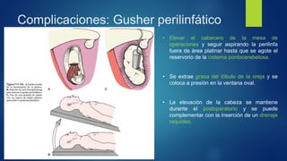 Complicaciones: Gusher perilinfático
• Elevar el cabecero de la mesa de
operaciones y seguir aspirando la perilinfa
fuera de área platinar hasta que se agote el
reservorio de la cisterna pontocerebelosa.
• Se extrae grasa del lóbulo de la oreja y se
coloca a presión en la ventana oval.
• La elevación de la cabeza se mantiene
durante el postoperatorio y se puede
complementar con la inserción de un drenaje
raquídeo.
 