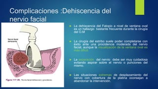 Complicaciones :Dehiscencia del
nervio facial
 La dehiscencia del Falopio a nivel de ventana oval
es un hallazgo bastante frecuente durante la cirugía
del O.M
 La cirugía del estribo suele poder completarse con
éxito ante una procidencia moderada del nervio
facial, aunque la visualización de la ventana oval es
más difícil.
 La separación del nervio debe ser muy cuidadosa
evitando aspirar sobre el nervio o punciones del
mismo.
 Las situaciones extremas de desplazamiento del
nervio con cobertura de la platina oconsejan a
abandonar la intervención.
 