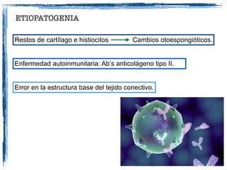 ETIOPATOGENIA
Restos de cartílago e histiocitos Cambios otoespongióticos.
Enfermedad autoinmunitaria: Ab’s anticolágeno tipo II.
Error en la estructura base del tejido conectivo.
 